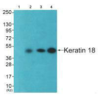 KRT18 antibody