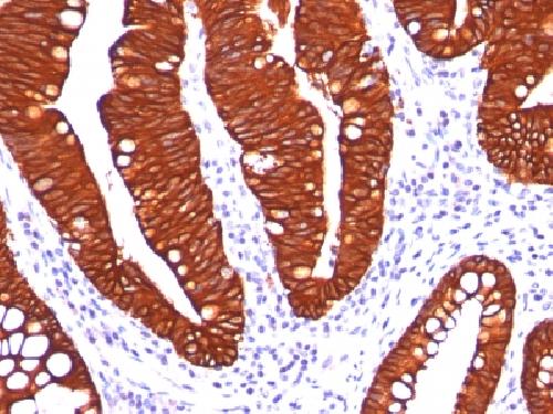 KRT19 Antibody
