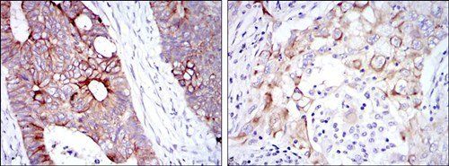 KRT19 Antibody