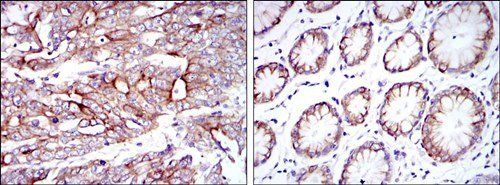 KRT19 Antibody