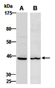KRT19 antibody pair