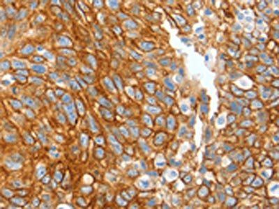 KRT2 Antibody