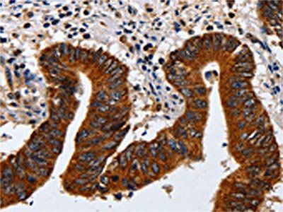 KRT23 antibody