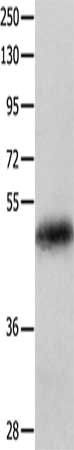 KRT23 antibody