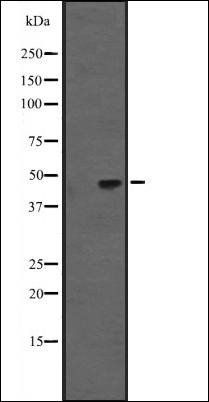 KRT31/33A/33B antibody
