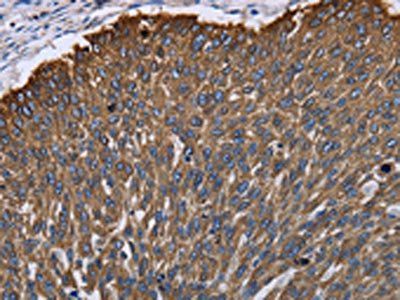 KRT31 Antibody