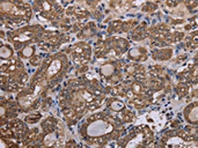 KRT31 Antibody