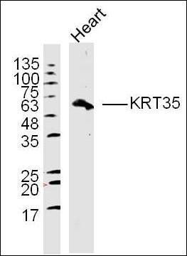 KRT35 antibody