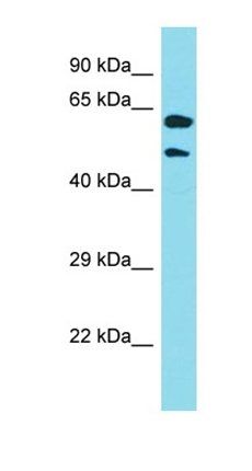 KRT39 antibody