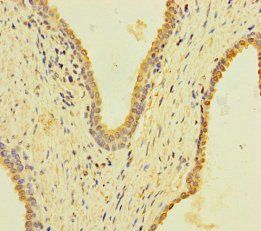 KRT40 Antibody