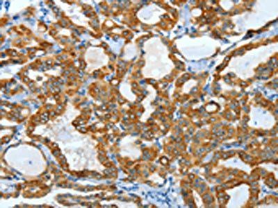 KRT40 Antibody