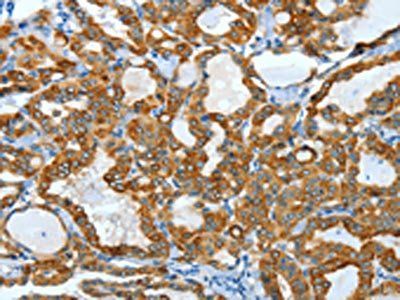 KRT40 antibody