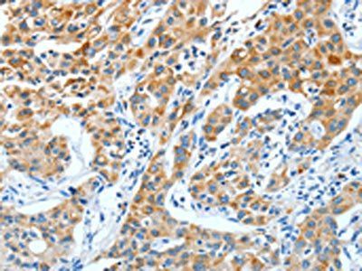 KRT40 Antibody