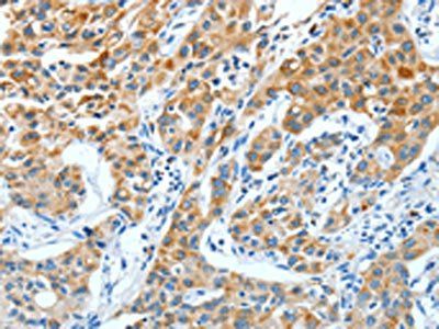 KRT40 antibody