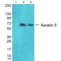 KRT5 antibody