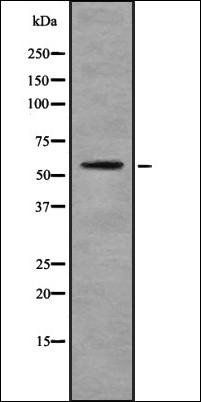 KRT6A antibody