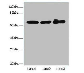 KRT6A antibody