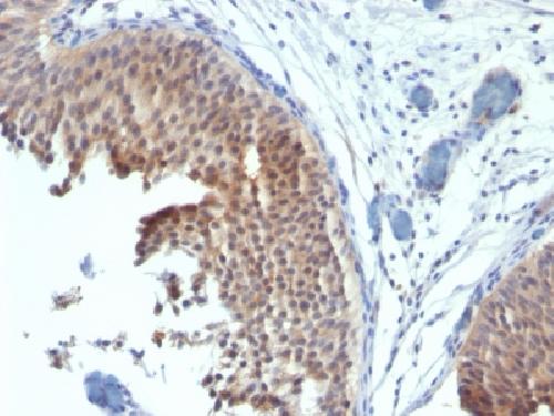 Cytokeratin 6 (Basal Cell Marker) Antibody