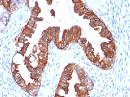 Recombinant Cytokeratin 7 (Glandular and Transitional Epithelial Marker) Antibody