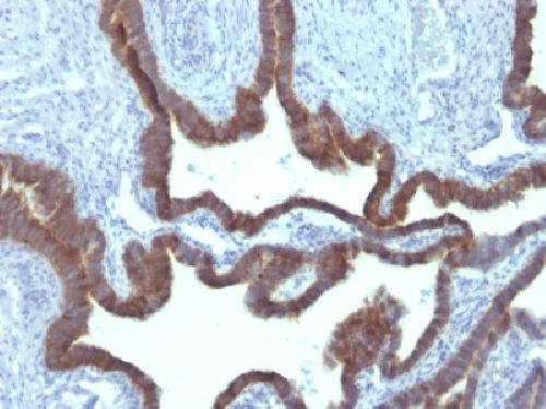 Cytokeratin 7 (Glandular and Transitional Epithelial Marker) Antibody