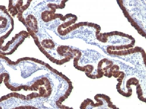 Cytokeratin 7 (Glandular and Transitional Epithelial Marker) Antibody