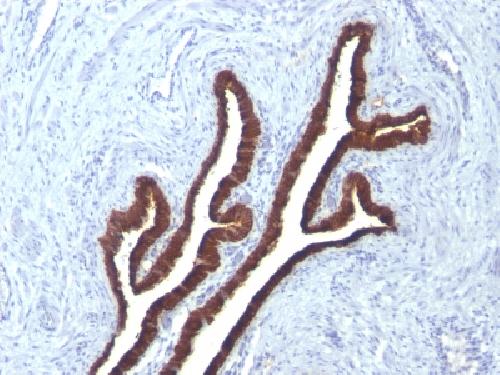 Cytokeratin 7 (Glandular and Transitional Epithelial Marker) Antibody
