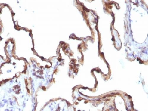 Cytokeratin 7 (Glandular and Transitional Epithelial Marker) Antibody