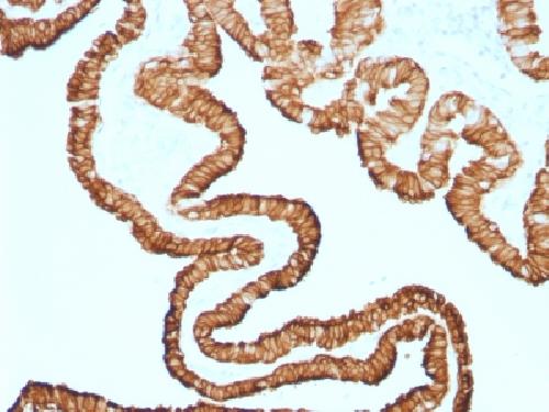Recombinant Cytokeratin 7 (Glandular and Transitional Epithelial Marker) Antibody