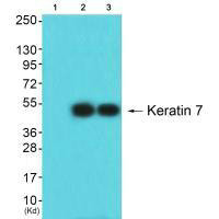 KRT7 antibody