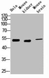 KRT7 antibody