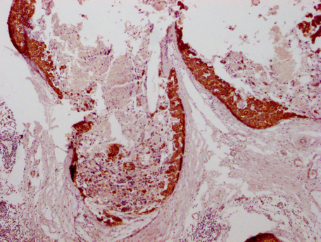 KRT7 Monoclonal Antibody