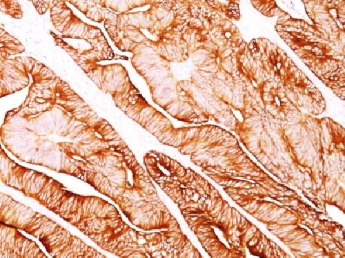 KRT8 Antibody