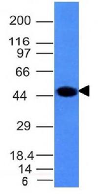 KRT8 Antibody