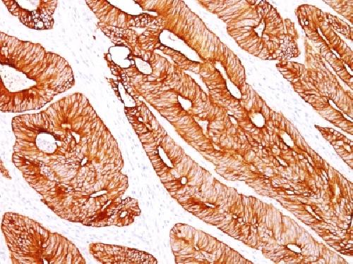 KRT8 Antibody