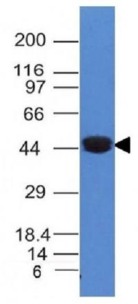 KRT8 Antibody