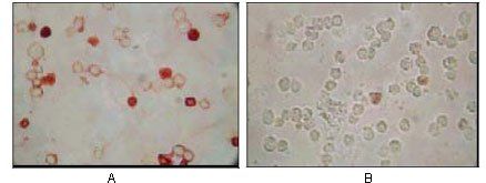 KSHV ORF62 Antibody