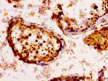 KSR2 Antibody