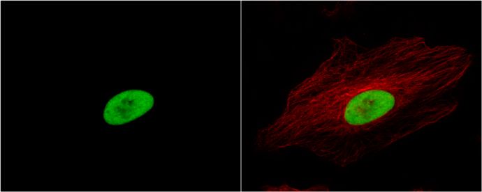 Ku80 antibody [N3C2], Internal