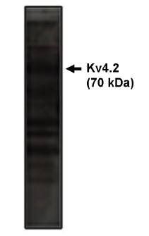Kv4.2 Potassium Channel antibody