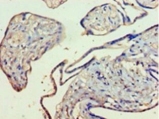 Kynurenine 3-monooxygenase antibody