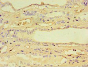 Kynurenine-oxoglutarate transaminase 1 antibody