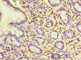 KYAT3 Antibody