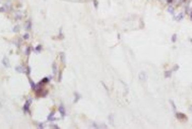 L-HDC antibody