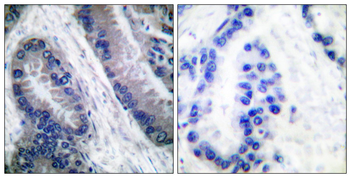 Caspase 1 (Cleaved-Asp210) antibody