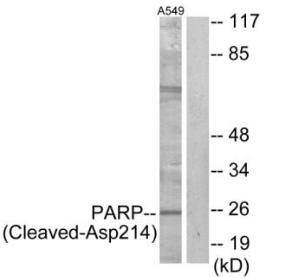 PARP (Cleaved-Asp214) antibody