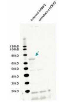 L1/ORF2 antibody