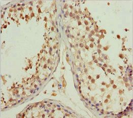 L2HGDH Antibody