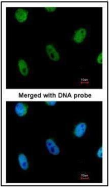 L3MBTL1 Rabbit Polyclonal Antibody
