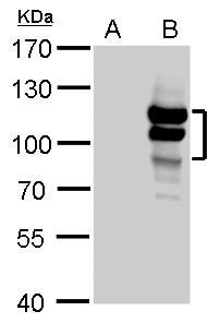 L3MBTL1 Rabbit Polyclonal Antibody