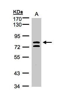 L3MBTL1 Rabbit Polyclonal Antibody